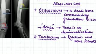 sequestrum involucrum and cloacae [upl. by Sim]