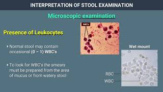 Interpretation of Stool Examination [upl. by Elise101]