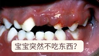 疱疹性齒齦口腔炎 Herpetic Gingivostomatitis [upl. by Anuait]