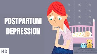 Postpartum Depression Part2 [upl. by Ahcirt]