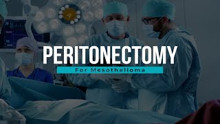 Peritonectomy for Mesothelioma  Mesothelioma Hope [upl. by Pauline]