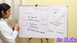 10 VALVULAR HEART DISEASE [upl. by Aubry]