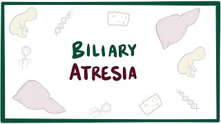 Biliary atresia  causes symptoms diagnosis treatment amp pathology [upl. by Corina]