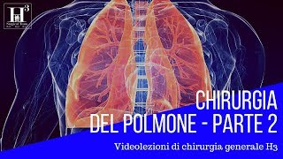 Chirurgia del polmone parte 2  patologie polmonari chirurgiche [upl. by East]