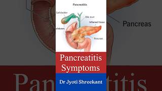 Pancreatitis symptoms shorts [upl. by Holly-Anne]