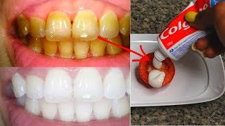 IN 2 MINUTES TURN YELLOW TEETH TO PEARLY WHITE WITH TOMATO [upl. by Borrell]