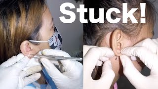 How to Remove Earring Stuck in Mom and Daughters Earlobe [upl. by Aynatahs]