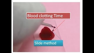 Blood clotting time without use of filter paper  slide method [upl. by Durward482]