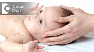 What is Craniosynostosis  Dr Derick Mendonca [upl. by Obed]