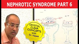 Nephrotic Syndrome  Part 6🩺 [upl. by Datha161]