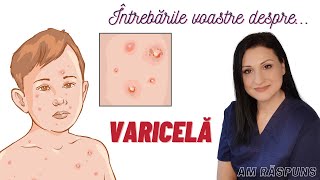 VARICELA la COPII Vărsat de vânt simptome tratament izolare [upl. by Aisnetroh]