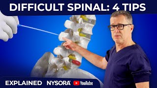 What to do when the needle encounters the bone during spinal or lumbar puncture [upl. by Stimson]