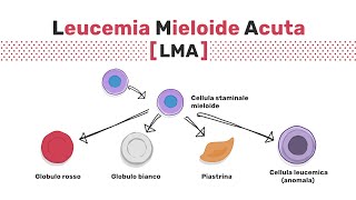 Tipi di leucemia mieloide acuta [upl. by Lurie577]