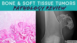 Bone amp Soft Tissue Pathology Board Review 21 Classic Cases [upl. by Encrata]