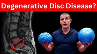 4 MustDo Exercises For Degenerative Discs In Lower Back Dont Skip These [upl. by Emilia]