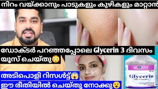 ഞെട്ടിച്ചു കളഞ്ഞു Glycerin😮Use glycerin daily for Amazing Results💯Shilpa sanjay glycerin [upl. by Nicolette]