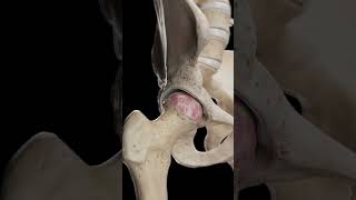 🦴 Hip Arthrosis When the Hip Joint Wears Down anatomy [upl. by Rebmyk]