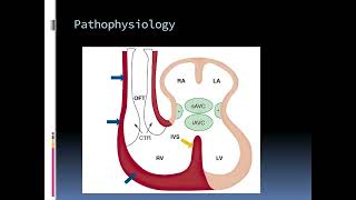 Cardiac Embryology The Key to Understanding Heart Development [upl. by Dutch]