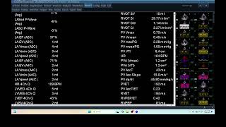 IQ 276 HEMODYNAMIC ECHOPAC ANALYSIS ECHOCARDIOGRAPHY REPORT [upl. by Toni]