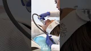 Revolutionary HIFU Face Lifting Treatment at EDEN AESTHETICS Clinic  NonSurgical Skin Tightening [upl. by Tirma]