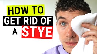 How to Get Rid of a Stye FAST  Chalazion VS Stye Treatment [upl. by Ardaed]