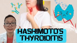 Ano ang Hashimotos thyroiditis   By Doc Mar [upl. by Seel]