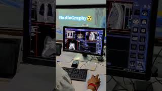 Radiography ☢️ radiology ctscan doctorslife paramedical xray knowledge learning [upl. by Nnarual]