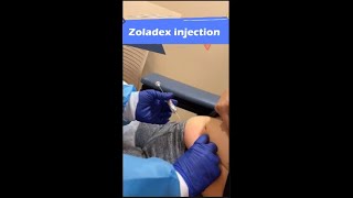 Zoladex injection خطوات حقن حقنة الزولادكس shorts [upl. by Barrada]