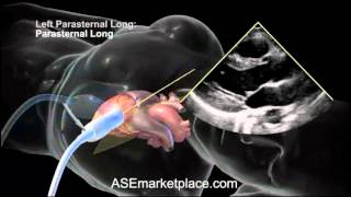 How to do a Basic Transthoracic Echocardiogram Transducer Position and Anatomy [upl. by Ccasi725]