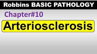 Ch10  Arteriosclerosis  Blood Vessel Pathology  Robbins Lectures [upl. by Swainson353]