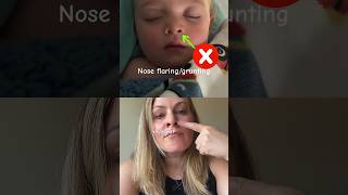 What does CROUP sound like amp Home Treatment for Croup [upl. by Cherrita]