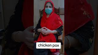 Chiken pox tretmentsymptomsdiagnosesviral infectionyoutubevideo [upl. by Ko]