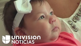 Bebé de dos meses vive las consecuencias del virus del Zika [upl. by Heisel]