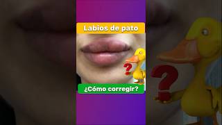 👄 Boca de pato después del Ácido Hialurónico ¿Cómo eliminar acidohialuronico labios [upl. by Kariotta901]