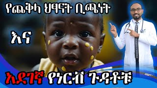 የጨቅላ ህፃናት ቢጫነት ካልታከመ የሚያመጣቸው የነርቭ ጉዳቶች  Neonatal Jaundice complications  DrFasil  ብሩህkids [upl. by Laenaj]