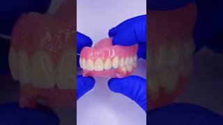 Look at these prostheses Upper acrylic and lower flexible mrdent dentist smile protesisdental [upl. by Eelarbed]