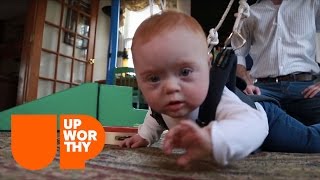 This Simple Harness Helps Down Syndrome Babies Development [upl. by Mafala7]