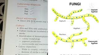 Superficial Mycoses  Fungal Infections [upl. by Cleti]