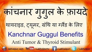 कांचनार गुगुल के फ़ायदे थायराइड ट्यूमर के लिए  Kanchnar Gugul Benefits For Thyroid and Tumor [upl. by Edee463]