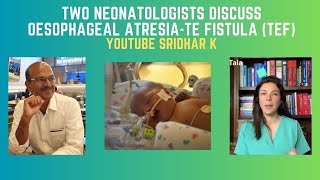 Practical discussion on Oesophageal atresia and TEF Dr Tala Dr Sridhar esophagealatresia tef nicu [upl. by Tennaj]