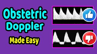 Obstetric Doppler Made Easy [upl. by Aret921]