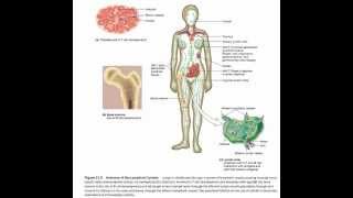 الحمى المالطية brucellosis  brucella [upl. by Ahsayn426]