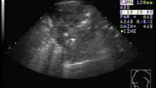 Foal with Rhodococcal Pneumonia Ultrasound  Merck Veterinary Manual [upl. by Isoais]