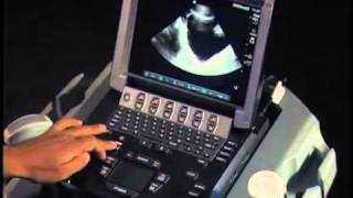 How To Ultrasound FAST Exam  Male Pelvis [upl. by Pedrick]