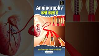 What is Angiography in Hindi angiography radiographerexam testpaperliveparamedicalclasses [upl. by Rutherford]