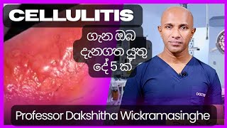 Cellulitis සෙලියුලයිටිස් ගැන ඔබ දැනගතයුතු දේ 5ක්  මහාචාර්ය දක්ෂිත වික්‍රමසිංහ [upl. by Descombes668]