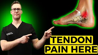 Posterior Tibial Tendonitis Treatment Inside of the Ankle Pain [upl. by Kela278]