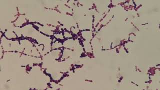 Gram positive bacteria becoming Negative [upl. by Rodenhouse]