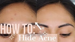 How To Hide Acne With Concealer  Easy How To Hide Acne or Acne Scars [upl. by Sirej]