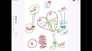 ECG شرح [upl. by Mcleroy]